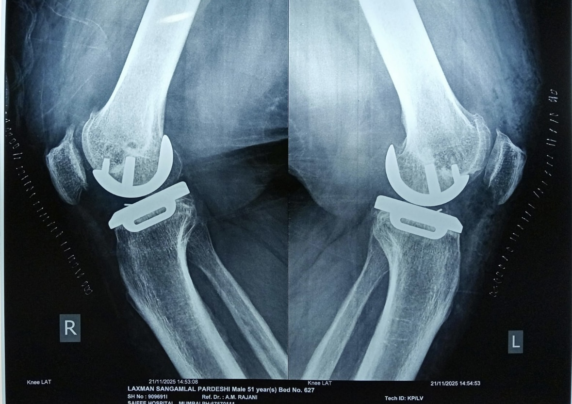 X-Ray report of the patient post-surgery.
